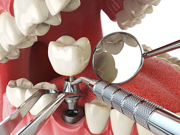 Best Pediatric Emergency Dentist in Collinsvle, IL